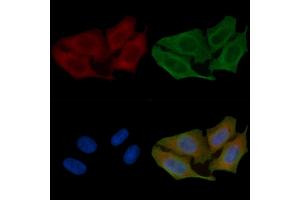 ABIN6261751 and ABIN6266842 staining Hela cells(45 min of heat-shock) by IF/ICC. (FARP2 抗体  (Internal Region))