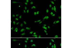 Immunofluorescence analysis of A549 cells using ANP32A Polyclonal Antibody (PHAP1 抗体)