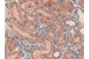 Detection of LOX1 in Rat Kidney Tissue using Polyclonal Antibody to Lectin Like Oxidized Low Density Lipoprotein Receptor 1 (LOX1)