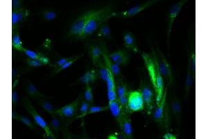 Image provided by One World Lab validation program. (Endoglin 抗体  (AA 58-110))