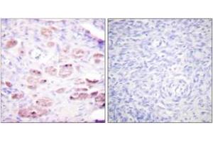 Immunohistochemistry analysis of paraffin-embedded human ovary, using Daxx (Phospho-Ser668) Antibody. (DAXX 抗体  (pSer668))