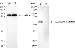 Western blotting analysis using asparagine synthetase antibody (ABIN7797662). (Recombinant Asparagine Synthetase 抗体)