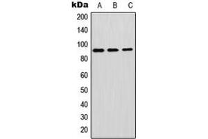 Western blot analysis of GPIPLD expression in A549 (A), mouse brain (B), H9C2 (C) whole cell lysates. (GPLD1 抗体  (Center))