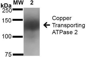 Western Blot analysis of Rat Brain Membrane showing detection of ~160 kDa Copper Transporting ATPase 2 protein using Mouse Anti-Copper Transporting ATPase 2 Monoclonal Antibody, Clone S62-29 . (ATP7B 抗体  (AA 3-21) (FITC))
