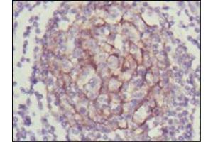 Immunohistochemistry (IHC) image for anti-Neurotrophic tyrosine Kinase, Receptor, Type 3 (NTRK3) (AA 32-429) antibody (ABIN969323)