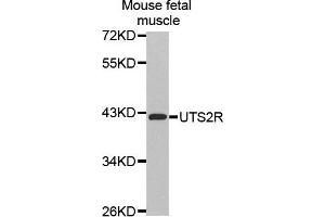 Western Blotting (WB) image for anti-Urotensin 2 Receptor (UTS2R) (AA 280-389) antibody (ABIN6219939) (UTS2R 抗体  (AA 280-389))
