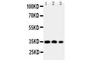 Anti-HOXA4 antibody, Western blotting Lane 1: SW620 Cell Lysate Lane 2: SW620 Cell Lysate Lane 3: PC-12 Cell Nuclear Lysate (HOXA4 抗体  (N-Term))