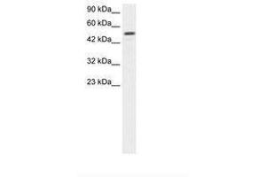 Image no. 1 for anti-Estrogen-Related Receptor gamma (ESRRG) (AA 190-239) antibody (ABIN202522) (ESRRG 抗体  (AA 190-239))