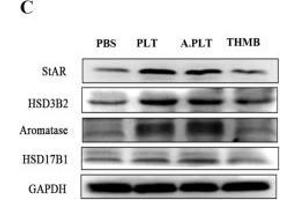 Western Blotting (WB) image for anti-Hydroxy-delta-5-Steroid Dehydrogenase, 3 beta- and Steroid delta-Isomerase 2 (HSD3B2) antibody (ABIN2855488)