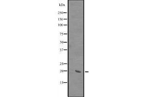 Western blot analysis of SIVA expression in HEK293 cells ,The lane on the left is treated with the antigen-specific peptide. (SIVA1 抗体  (Internal Region))