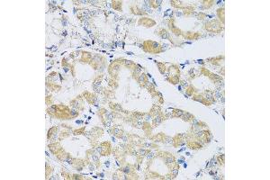 Immunohistochemistry of paraffin-embedded human stomach using ATPIF1 antibody at dilution of 1:100 (x40 lens). (ATPase Inhibitory Factor 1 抗体)