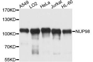 Western blot analysis of extracts of various cell lines, using NUP98 antibody. (NUP98 抗体  (AA 621-920))