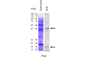 Image no. 1 for anti-Superoxide Dismutase 1, Soluble (SOD1) antibody (ABIN3197496) (SOD1 抗体)