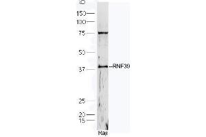 Human Raji cell lysates probed with Rabbit Anti-RNF39 Polyclonal Antibody, Unconjugated  at 1:5000 for 90 min at 37˚C. (RNF39 抗体  (AA 182-230))