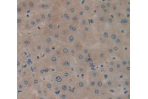 IHC-P analysis of Human Tissue, with DAB staining. (GLA 抗体  (AA 147-371))