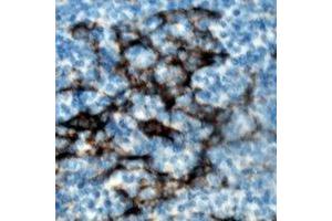Immunohistochemical analysis of ZAP70 (pY319) staining in human tonsil formalin fixed paraffin embedded tissue section. (ZAP70 抗体  (pTyr319))