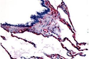 Human Respiratory Epithelium, Bronchial Smooth Muscle, and Alveoli (formalin-fixed, paraffin-embedded) stained with CAV1 antibody ABIN213405 at 3 ug/ml followed by biotinylated goat anti-rabbit IgG secondary antibody ABIN481713, alkaline phosphatase-strepta . (Caveolin-1 抗体  (N-Term))