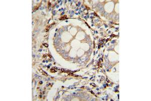 Immunohistochemistry (Paraffin-embedded Sections) (IHC (p)) image for anti-Amine Oxidase, Copper Containing 3 (Vascular Adhesion Protein 1) (AOC3) (AA 613-640) antibody (ABIN652478)