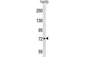 CHADL Antibody (Center) western blot analysis in T47D cell line lysates (35µg/lane). (CHADL 抗体  (Middle Region))