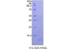 SDS-PAGE analysis of Human Nucleophosmin Protein. (NPM1 蛋白)