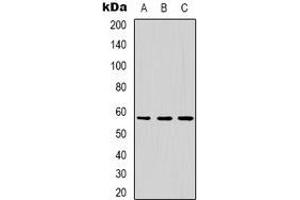 Western blot analysis of Dyskerin expression in MCF7 (A), HepG2 (B), Jurkat (C) whole cell lysates. (DKC1 抗体)