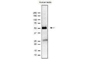 Western Blotting (WB) image for anti-Izumo Sperm-Egg Fusion 1 (IZUMO1) antibody (ABIN2452040) (IZUMO1 抗体)