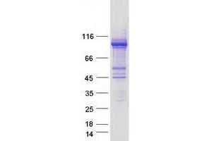 Validation with Western Blot (ube3a Protein (Transcript Variant 3) (Myc-DYKDDDDK Tag))