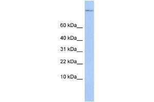 WB Suggested Anti-TSC22D1 Antibody Titration:  0. (TSC22D1 抗体  (Middle Region))