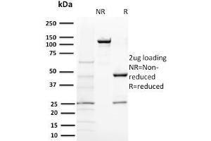 SDS-PAGE Analysis Purified BAP1 Mouse Monoclonal Antibody (BAP1/2431). (BAP1 抗体  (AA 191-326))