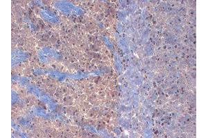 KvBeta Immunohistochemistry.