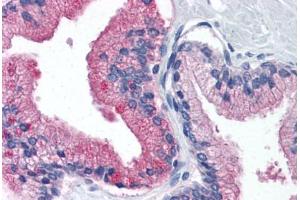 Human Prostate (formalin-fixed, paraffin-embedded) stained with B2M antibody ABIN364376 at 10 ug/ml followed by biotinylated anti-mouse IgG secondary antibody ABIN481714, alkaline phosphatase-streptavidin and chromogen. (beta-2 Microglobulin 抗体)