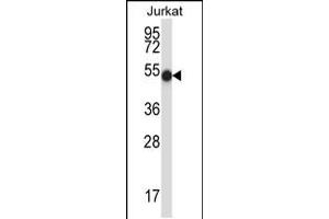 Western blot analysis in Jurkat cell line lysates (35ug/lane). (PNKP 抗体  (N-Term))