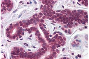 Human Breast: Formalin-Fixed, Paraffin-Embedded (FFPE) (T-Box 18 抗体  (AA 511-560))