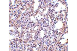 Immunohistochemistry of EIF2AK2 in rat lung tissue with EIF2AK2 polyclonal antibody  at 2.