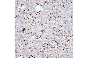 Immunohistochemistry of paraffin-embedded rat brain using //IB Rabbit mAb (9776) at dilution of 1:100 (40x lens). (Iba1 抗体)