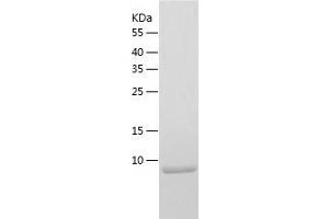 Olfactomedin 1 Protein (OLFM1) (AA 34-135) (His tag)