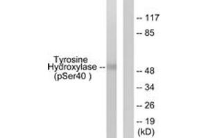 Western blot analysis of extracts from RAW264. (Tyrosine Hydroxylase 抗体  (pSer71))