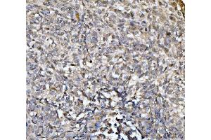 IHC analysis of EXOSC8 using anti-EXOSC8 antibody (ABIN7601850).