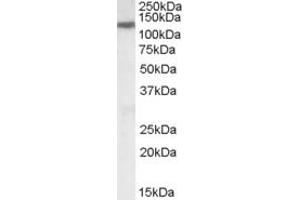 Image no. 2 for anti-Solute Carrier Family 12 (Potassium-Chloride Transporter) Member 6 (SLC12A6) (Internal Region) antibody (ABIN238578)