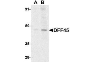 Western blot analysis of DFF45 in HeLa cell lysate with AP30290PU-N DFF45 antibody at (A) 1 and (B) 2 μg/ml. (DFFA 抗体  (N-Term))