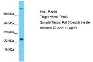 Image no. 1 for anti-Dynactin 5 (p25) (DCTN5) (N-Term) antibody (ABIN6750438) (DCTN5 抗体  (N-Term))