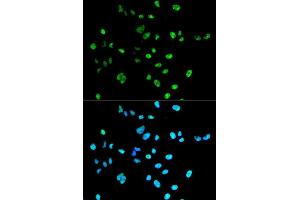 Immunofluorescence analysis of A549 cell using PAX2 antibody. (PAX2A 抗体)