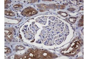 Immunohistochemistry (IHC) image for anti-Crystallin, alpha A (CRYAA) antibody (ABIN1498754) (CRYAA 抗体)