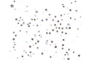 Immunocytochemistry (ICC) image for anti-Spleen Focus Forming Virus (SFFV) Proviral Integration Oncogene Spi1 (SPI1) (AA 1-50) antibody (ABIN7455165)