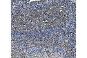 IHC analysis of eRF1/ETF1 using anti-eRF1/ETF1 antibody (ABIN7602626).