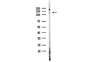 Western blot analysis of lysates from Hela cells(heat-shock,45 min treatment), using RFC1 Antibody at 1/1000 dilution.