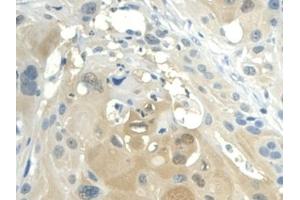 Immunohistochemistry (IHC) image for anti-Nicotinamide phosphoribosyltransferase (NAMPT) (AA 1-491) antibody (ABIN7432295)