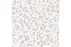 Immunohistochemistry (IHC) image for anti-Mediator Complex Subunit 1 (MED1) (AA 1550-1581) antibody (ABIN7455140)