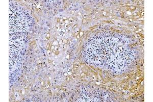 IHC analysis of ACLY using anti-ACLY antibody (ABIN4886416). (ACLY 抗体  (AA 1-180))