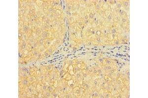 Immunohistochemistry of paraffin-embedded human liver tissue using ABIN7155373 at dilution of 1:100 (H2AFB1 抗体  (AA 1-115))